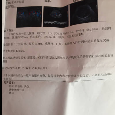 胎儿35周发育标准数值