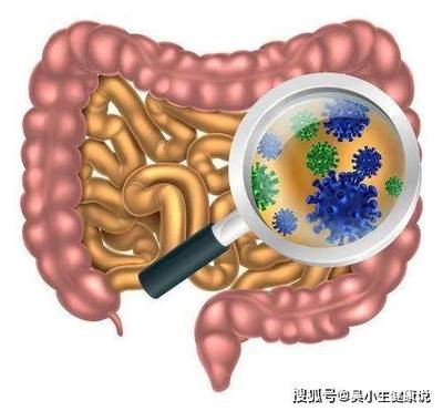 肠息肉是怎么回事