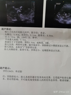怀孕多久做nt和唐筛