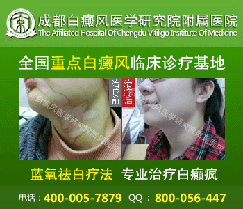 成都皮炎所治痘痘