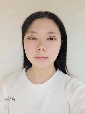 割双眼皮消炎针打几天