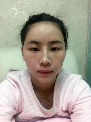 越然医疗美容靠谱吗