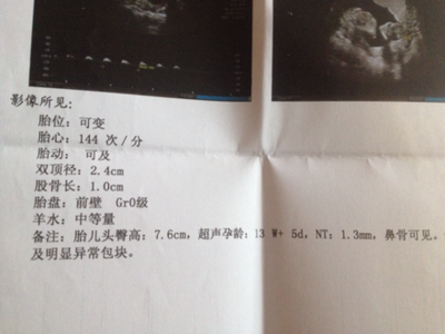 怀孕13周胎心率多少正常