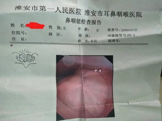 怎么治疗扁桃体肥大
