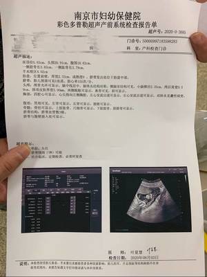胎儿发育小