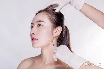 玻尿酸能打哪里