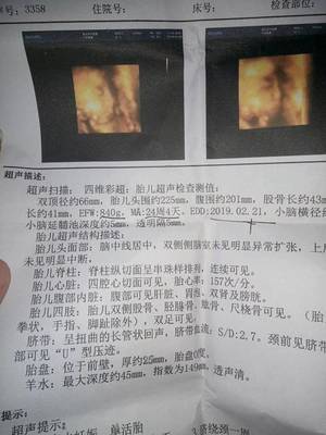 怀孕25周胎儿有多大