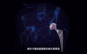 手颤抖怎么治疗