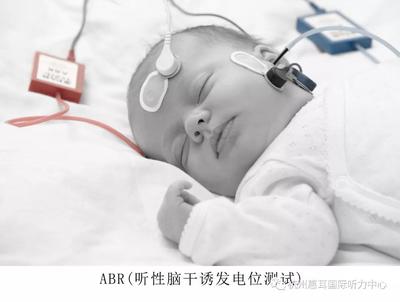 新生儿听力筛查最佳时间