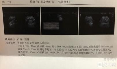 空腹胃难受是怎么回事