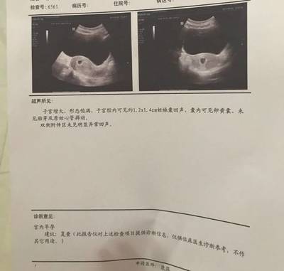 两个月胎儿图片