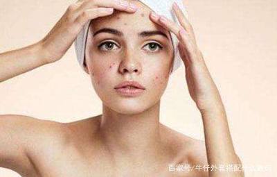 怎样防止痘痘再长