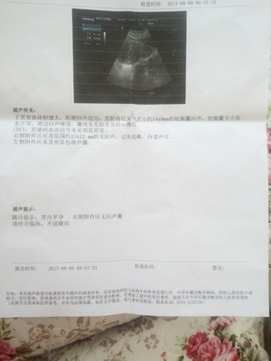 怀孕40天孩子多大