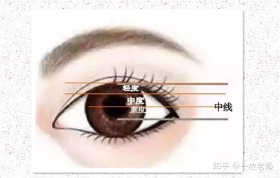 提肌双眼皮一般多少钱