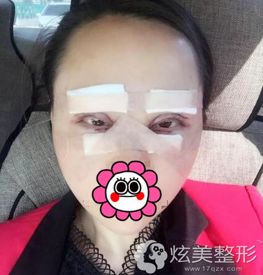 打了玻尿酸痛怎么办
