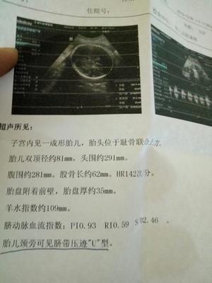 32周胎宝宝