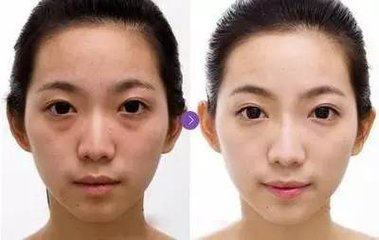 梧州整容华美出众