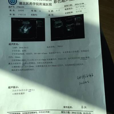 一般几天会怀孕