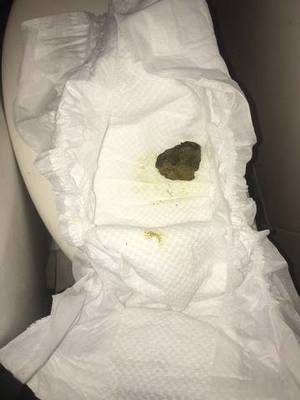 孕妇拉屎很臭
