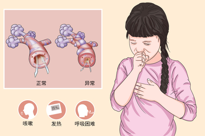 小儿咳嗽喘的厉害怎么办