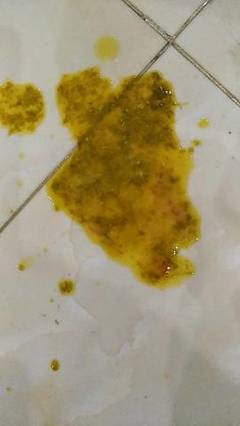六个月宝宝大便有血丝