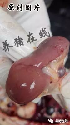 肠道淋巴结肿大是怎么回事