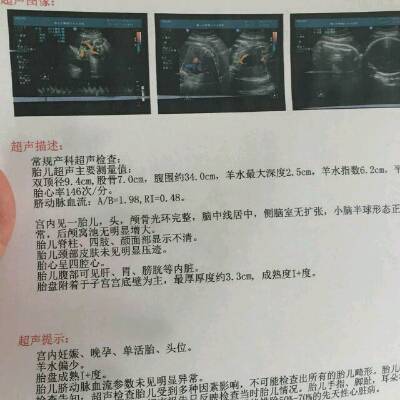 怎样检查胎儿是否缺氧