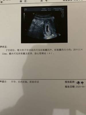 怀孕五周见红怎么回事