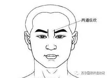 眉心八字纹