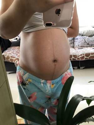 1岁宝宝肚子大正常吗