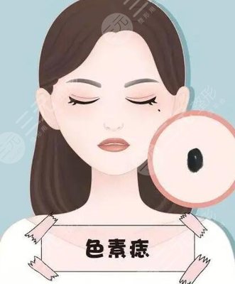 点痣留下的疤能消失吗