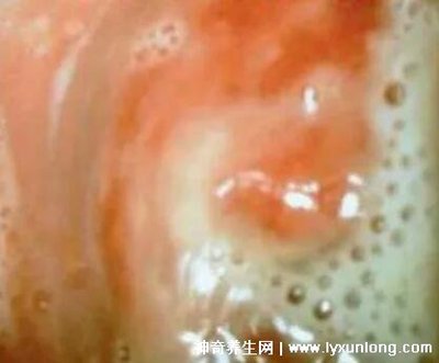 来月经味道腥臭是怎么回事