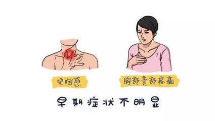 食道疼是怎么回事