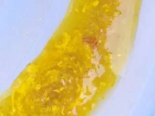 宝宝拉蛋花样大便