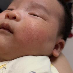 宝宝吐奶粘稠像痰一样怎么回事