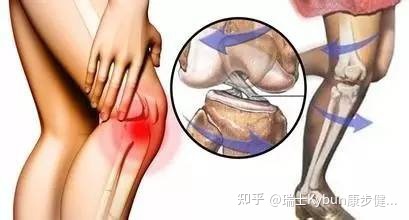 膝盖关节响是怎么回事
