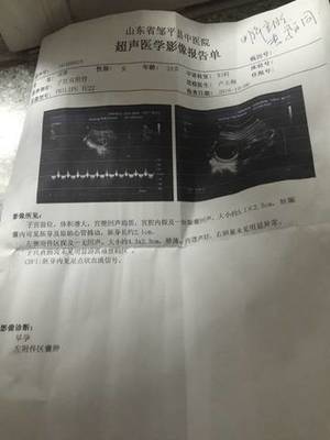 怀孕卵巢囊肿怎么办