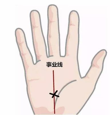 为什么手上没有事业线