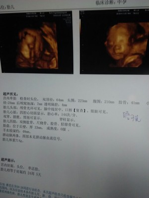 怀孕了怎么看男女