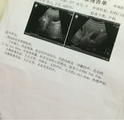 怀孕7周有胎心胎芽吗