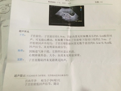 怀孕一个月感冒了会影响胎儿吗
