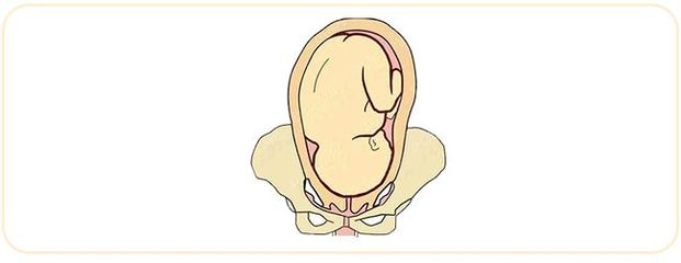 臀位多少周剖腹产为宜