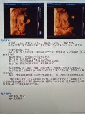 怀孕六个月做四维晚吗