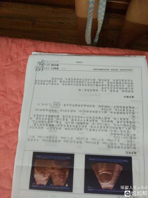 9伏2安多少瓦