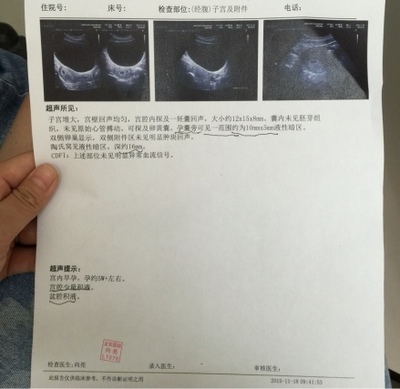 怀孕半个月会流产吗