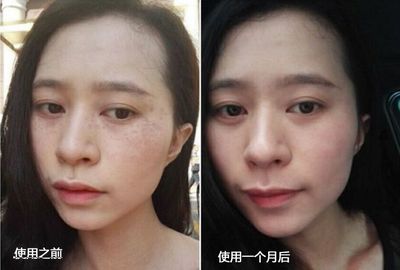 粉底过敏症状