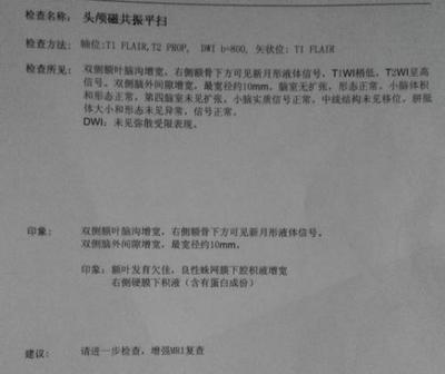 宝宝做核磁共振危害
