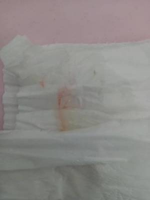 怀孕了白带会变多吗