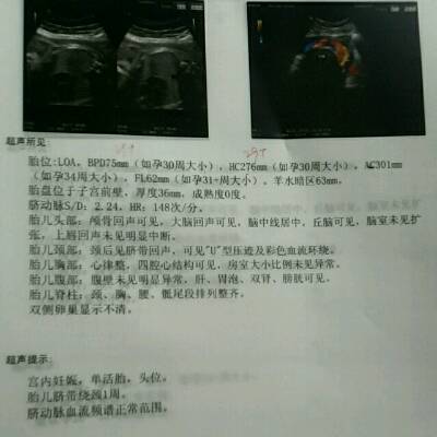 怀孕八个月正常的羊水是多少正常吗