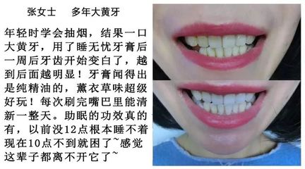 31颗牙齿的命运解析